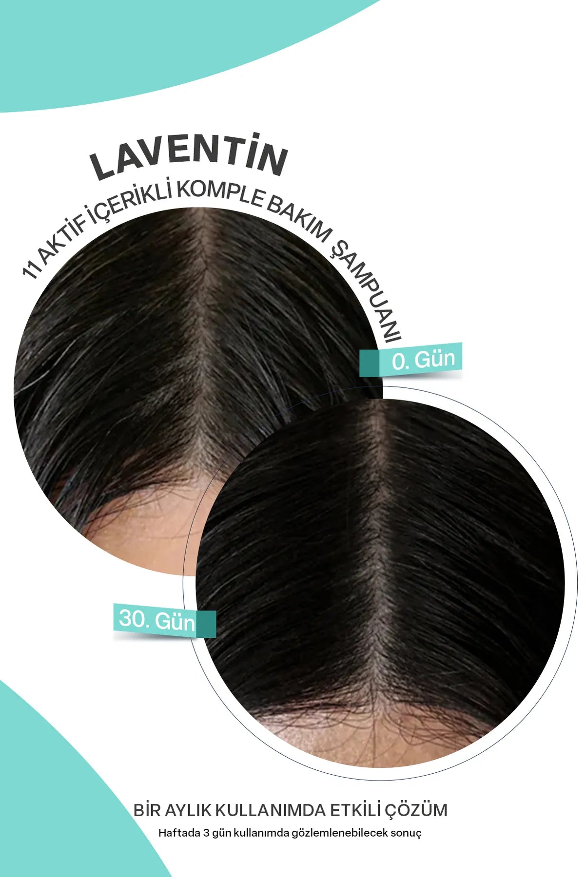 Laventin Anti-Haarausfall-Shampoo mit 11 Wirkstoffen für Haarausfall und langsam wachsendes Haar, 400 ml